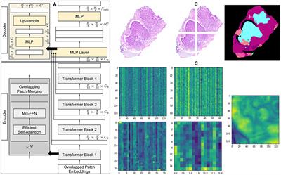 Transformer-based framework for multi-class segmentation of skin cancer from histopathology images